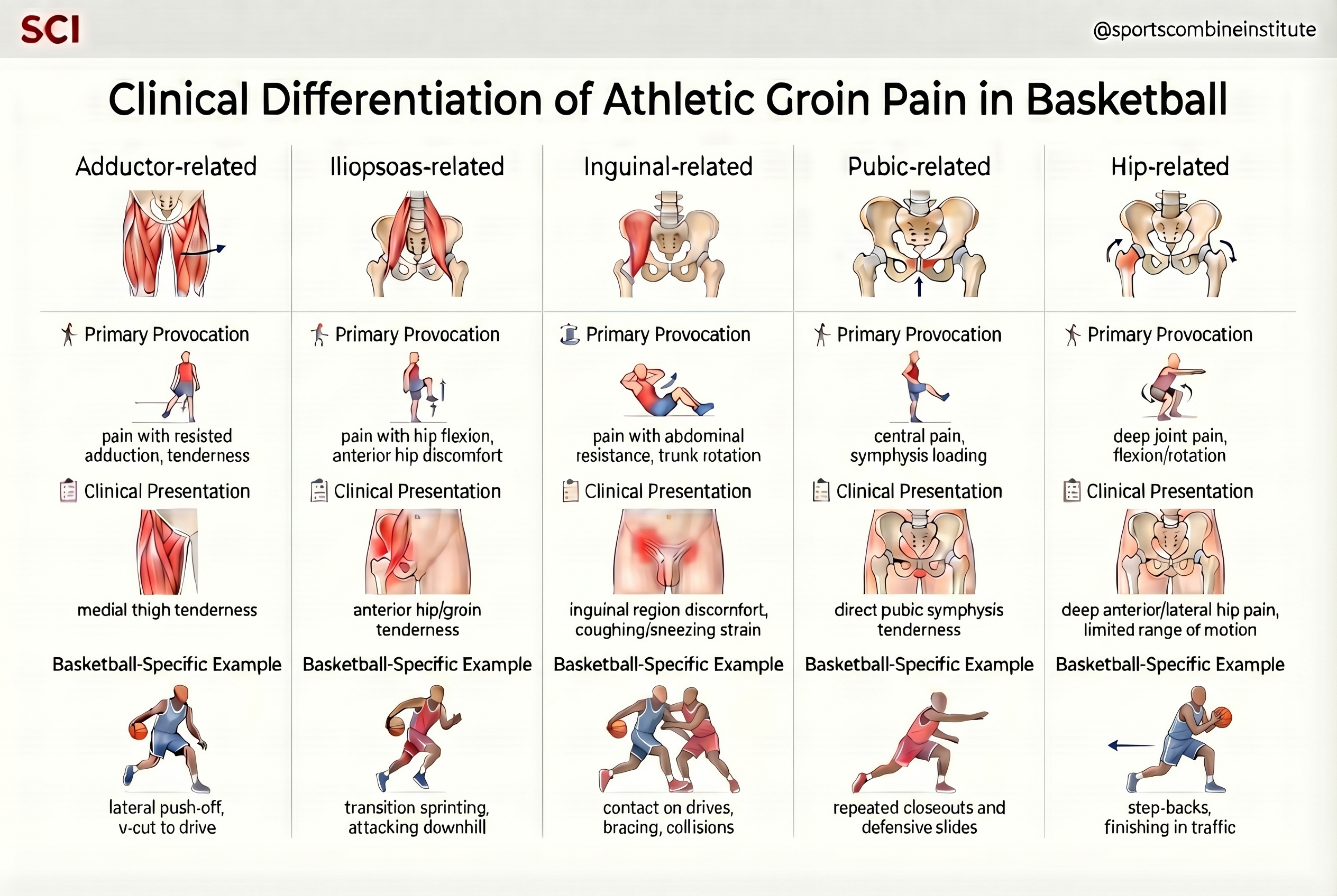 Figure 1: Clinical Differentiation of Athletic Groin Pain in Basketball